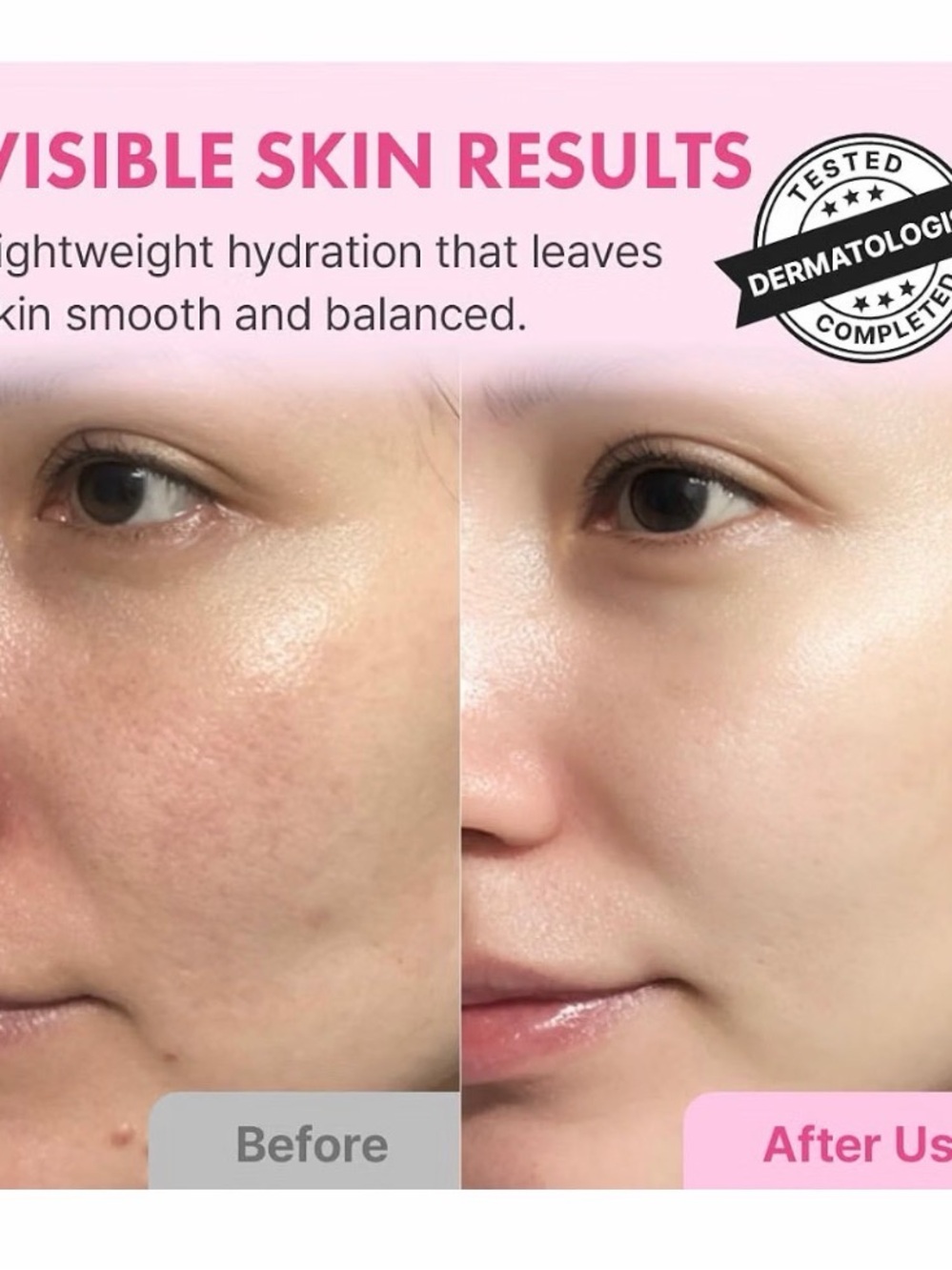 3/$15 🌸 Hanskin Hyaluron Skin Essence Serum - Mini - Picture 3 of 9